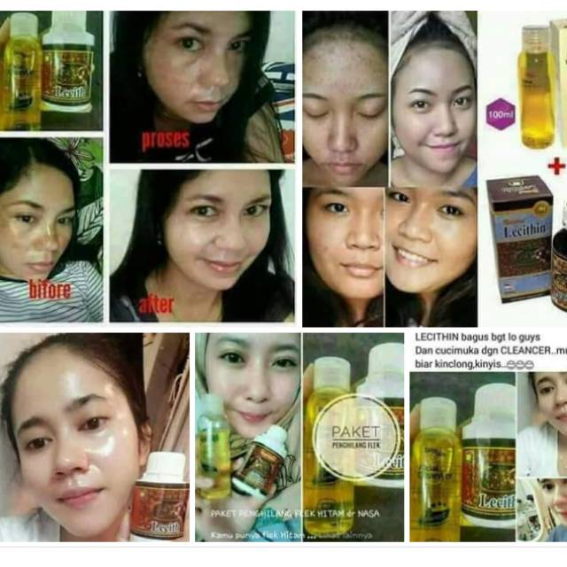 PAKET FLEK HITAM NASA