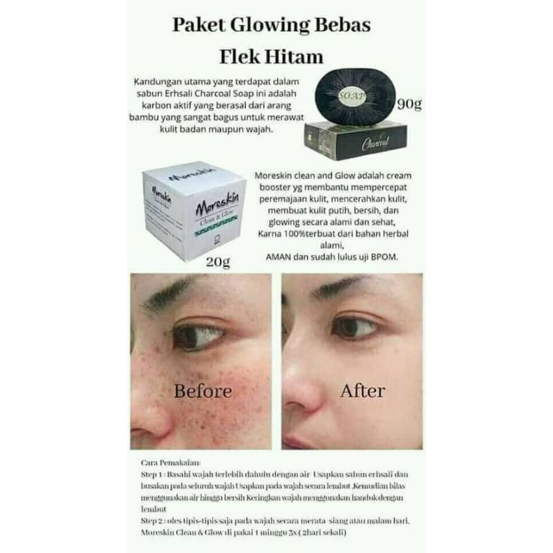 paket flek hitam nasa