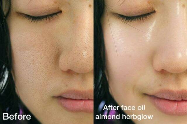 HERBIGLOW Face Oil Almond 10 ml - Serum Menutrisi &amp; Pelembab Wajah