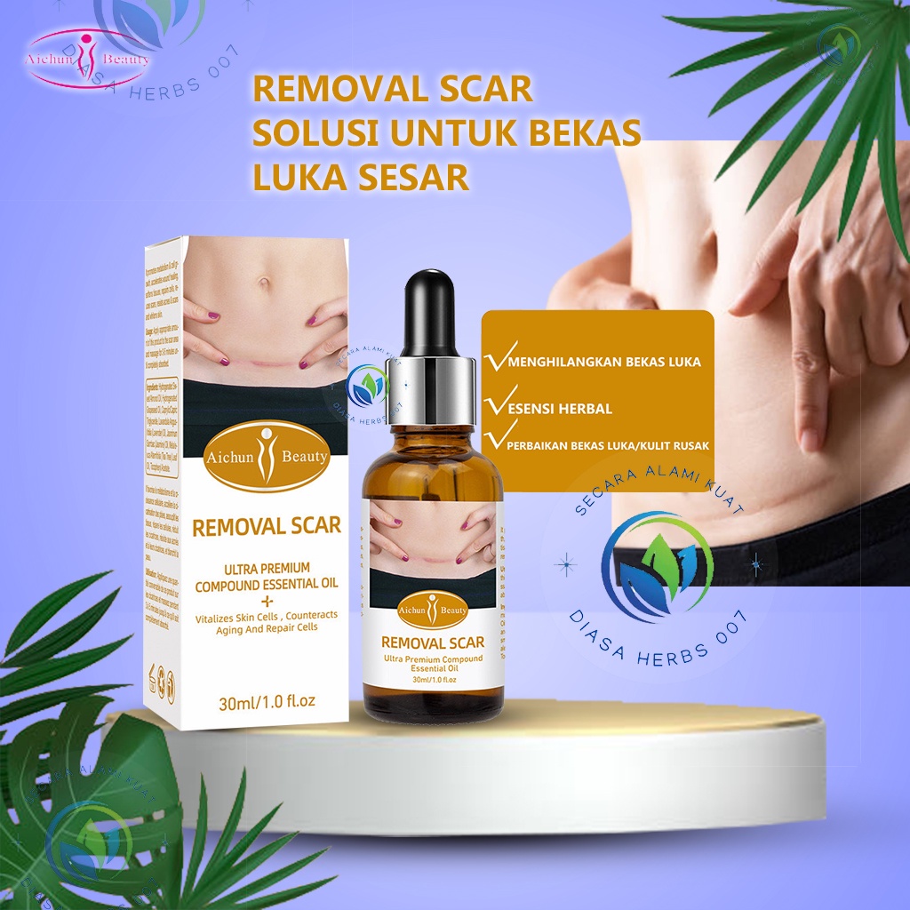 Aichun Herbs Remove Scar Pregnancy penghilang bekas luka pasca operasi