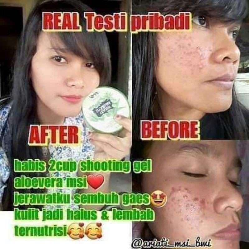 Alloveragell (ORIGINAL 100% PRODUK MSI)