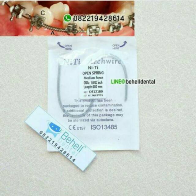 HIGH QUALITY KAWAT NITI OPEN COIL SPRING FDA OCS // Wire Dental Ortho Bracket Behel Gigi Orthodontic Koil Per Pegas // Untuk Merapatkan Ruang Gigi Original