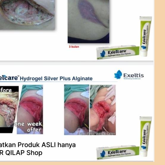 ⅎ Luka Exelcare Hydrogel Silver + Alginat (Penyembuh Luka Infeksi) ♦