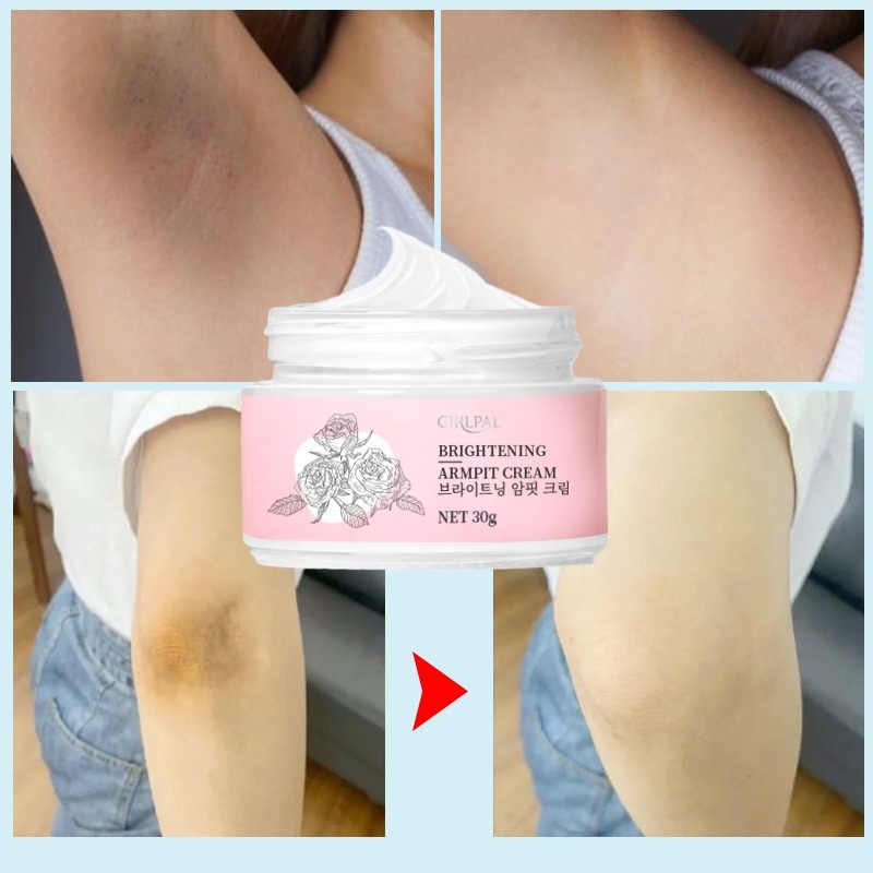 Girlpal Axillary Underarm Cream Krim Pemutih Ketek Ketiak Dan Pencerah Lipatan Selangkangan Bokong Dan Miss v Ampuh Bpom