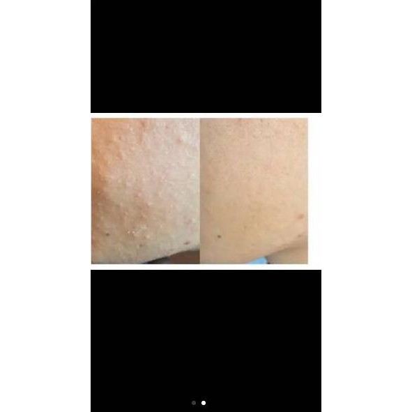 ☋ ACWELL - Licorice pH Balancing cleansing toner 150 ML  / ACWELL TONER ➤