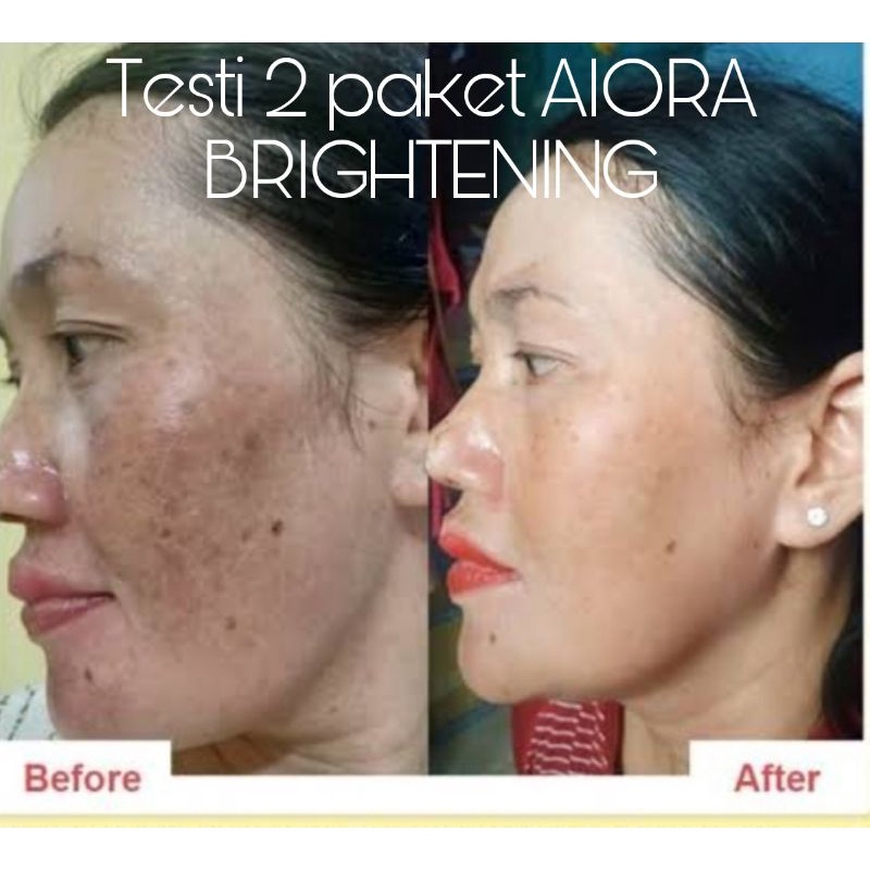 AIORA SKINCARE BPOM CREAM WAJAH PAKET GLOWING ACNE-6