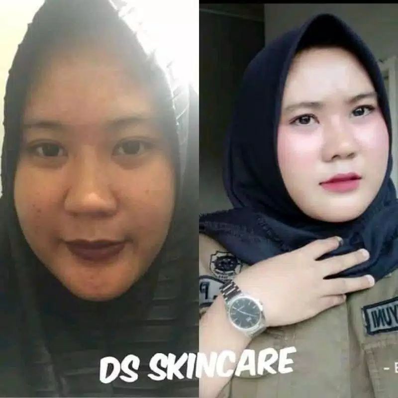 Paket Glowing Ds Skincare REAL