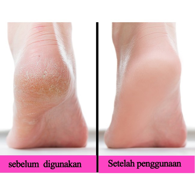 krim kaki 100g obat kaki pecah dan kering krim kaki Exfoliating Kapalan Smoothing Krim Kaki Memperbaiki tumit pecah-pecah dan kering