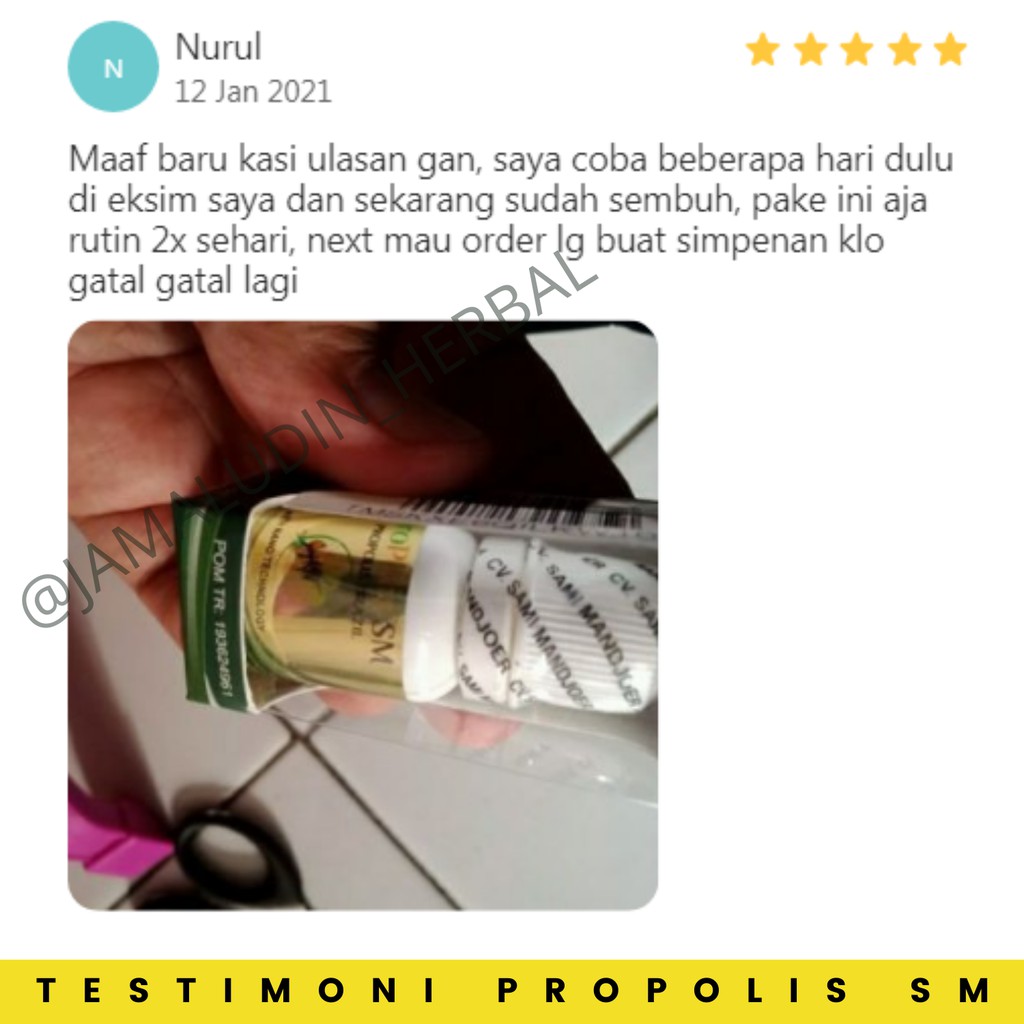 Obat Eksim Kering Basah Kering  Gatal Gatal Jamur Kulit Kepala Salep Eksim Scabies Obat Gatal Kudis Kurap Kutu Air Obat Gatel Selangkangan Berjamur Aman Balita Propolis SM Brazil Original 100% Asli-2
