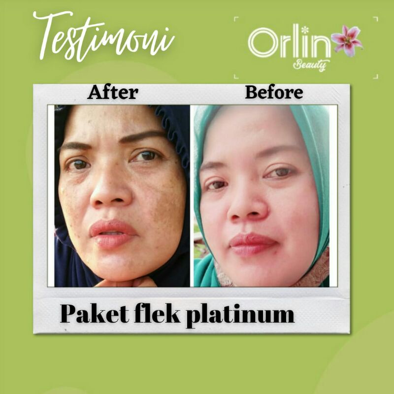 paket flek whitening platinum/orlin beauty/free bonus cantik/orlin
