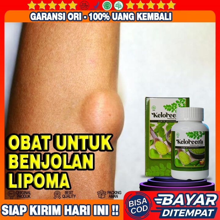 Obat Benjolan Lipoma,  Obat Penghilang Lipoma, Obat Penghancur Lipoma