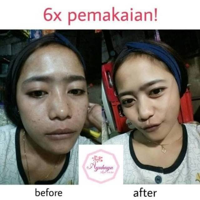 MASKER WAJAH ORGANIK JELITA OBAT JERAWAT ALAMI KOMEDO PEMUTIH PENCERAH HALAL HERBAL GREENTEA COFFEE