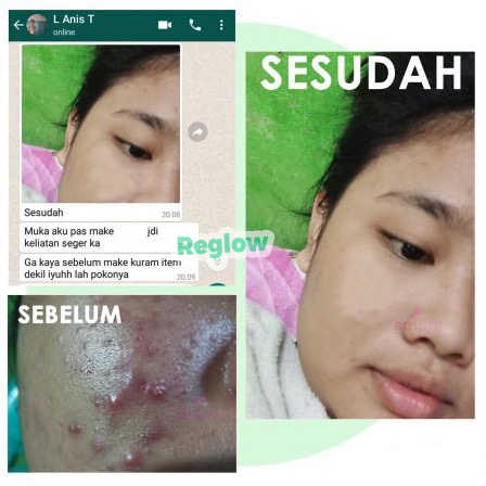 REGLOW CREAM KRIM CREM REJUVENATING INTENSIVE CREAM WAJAH KRIM PENGHILANG JERAWAT ORIGINAL 100% BPOM PENGHILANG BEKAS JERAWAT PENGHILANG FLEK HITAM