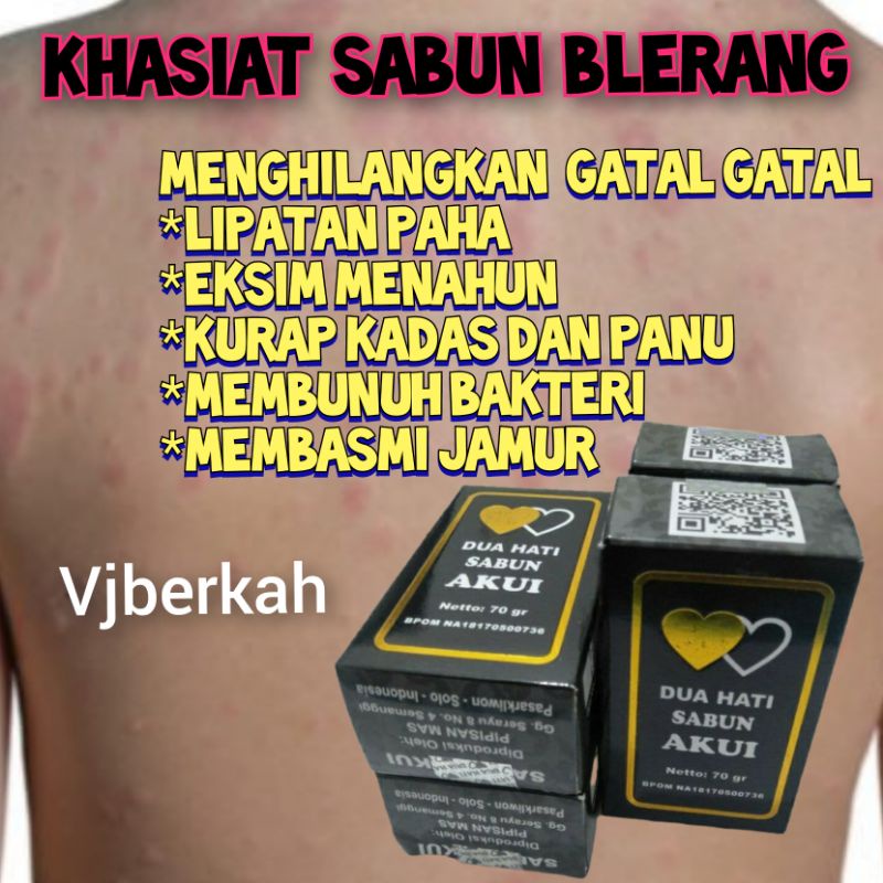 (COD) DIJAMIN ASLI 100% SABUN GATAL AKUI BELERANG 70gram MEMBASMI PENYAKIT KULIT GATAL PANU KADAS KURAP ALERGI