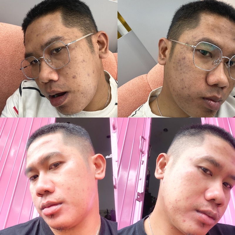 BIG SALE DISC50% SABUN PENCERAH KIMMY BEAUTY GLOW Pemutih Wajah Pria Pemutih Badan Pria Pemutih Kuli