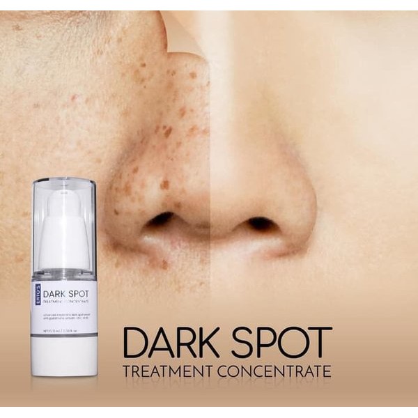 Promo     Ertos Dark Spot Treatment Concentrate Erto Treatmen Concentrat Skincare Skin Care Serum