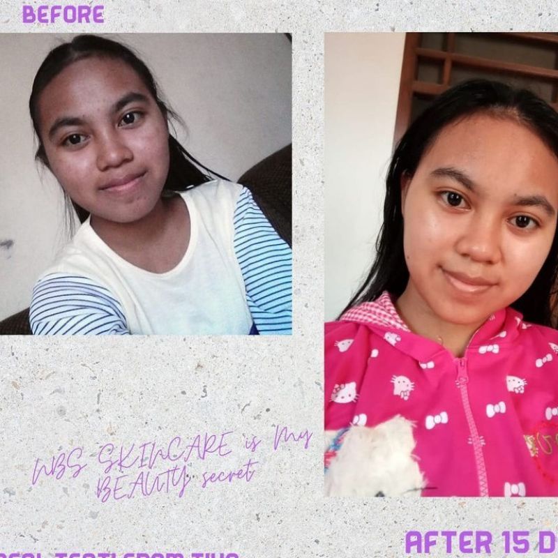 NBS skincare original