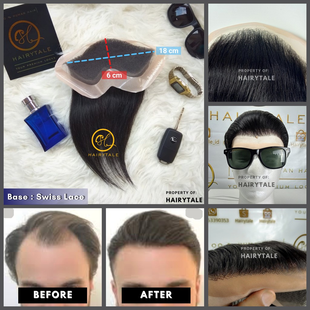 Toupee / tutup botak dahi pria, Swiss Lace, luas 5x18 cm/custom size, Hairytale 100% Human Hair