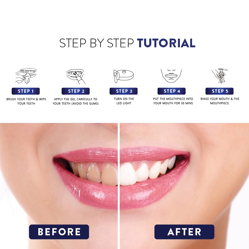 Beaudelab Professional Teeth Whitening Pen BPOM | Professional Pen Pemutih Gigi-1