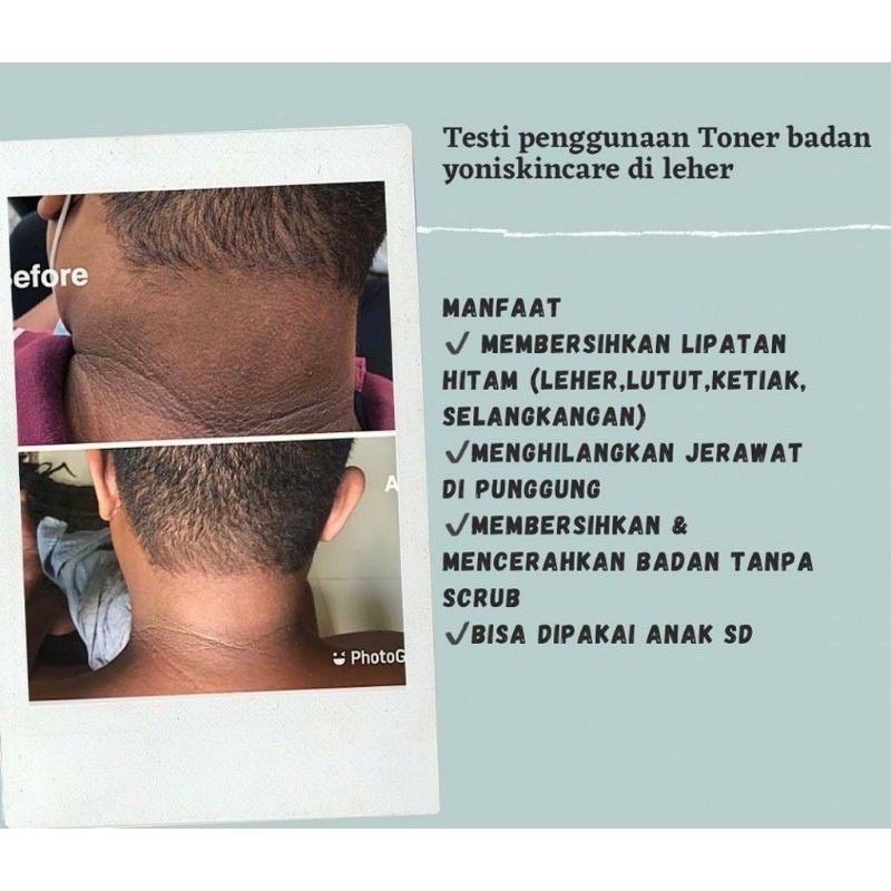 TONER BADAN YONII SKINCARE /TONER RONTOK DAKI PEMBERSIH BADAN