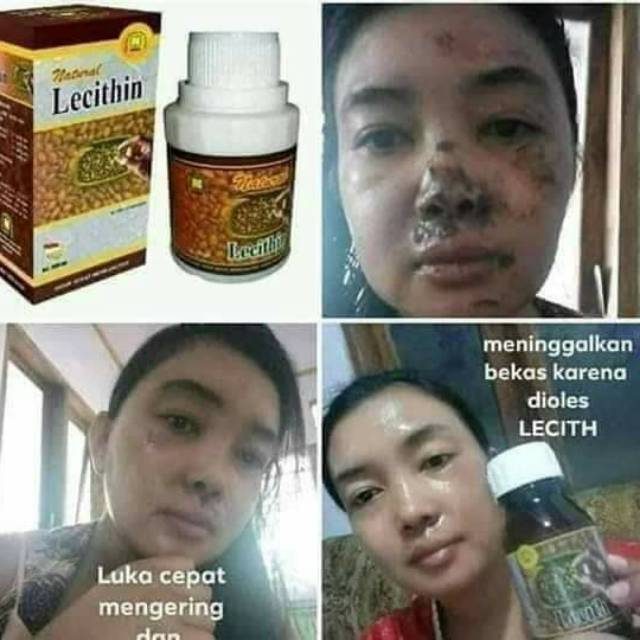 LECITHIN NATURAL NUSANTARA SIKECIL 1000 MANFAAT