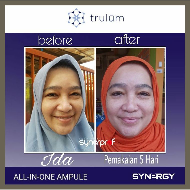 Krim Wajah Pria Wanita Obat Penghilang Flek Hitam Keriput Wajah Cepat