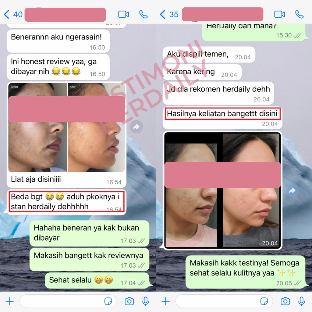 HER DAILY - PERBAIKI TEKSTUR KULIT DAN MEMUTIHKAN WAJAH DALAM 7 HARI - VIT D3 GLUTATHIONE