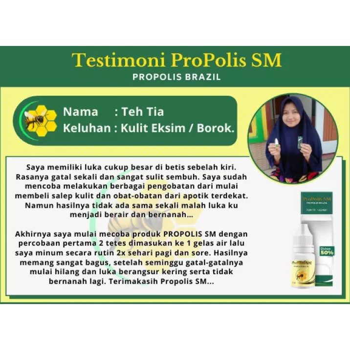 Obat Gatal Berair, Penghilang Gatal, Bernanah Gatal Berair, Menyebar Gatal Berair, Gatel Beair - Propolis SM-1