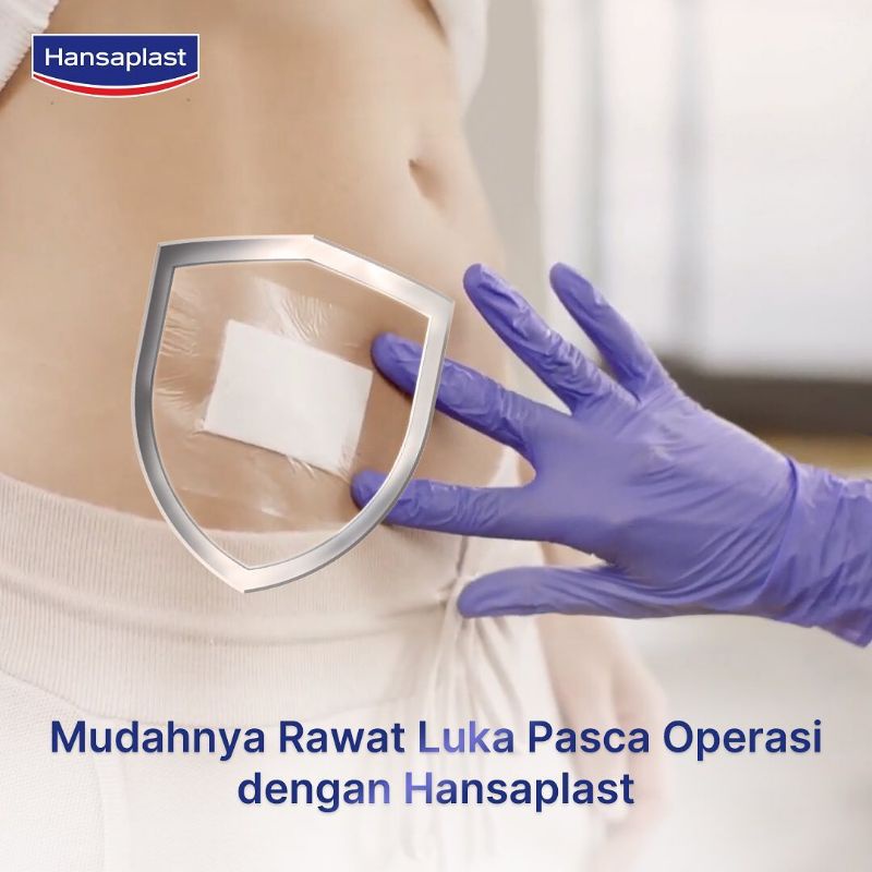 HANSAPLAST KASA STERIL - PENUTUP LUKA