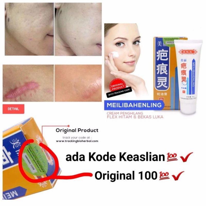 MEILIBAHENLING BIOHERBAL ORIGINAL ASLI BPOM HALAL, CREAM PENGHILANG BEKAS LUKA, KELOID, STRECH MARK, FLEK HITAM, BEKAS CACAR, BEKAS JERAWAT, KORENG DAN BOPENG