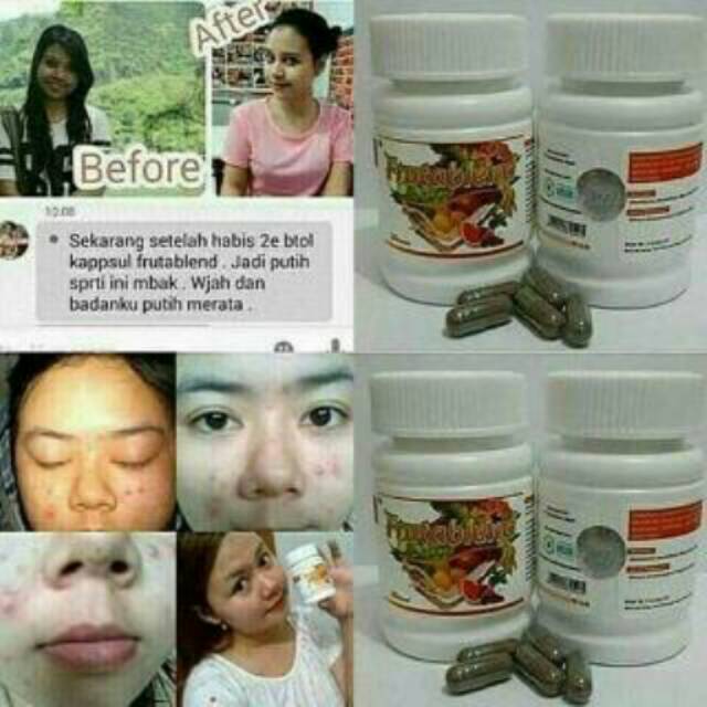 Frutablend Asli HWI/ Obat jerawat