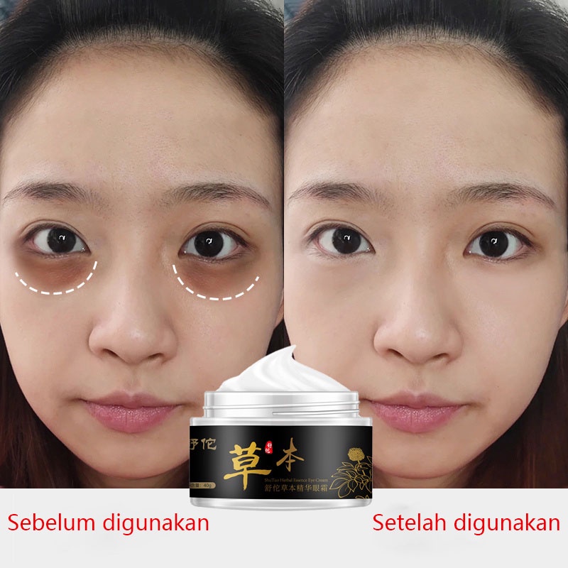 serum mata cream mata panda dan kantung mata Krim mata 40g Ekstrak Sari Herbal Shutuo Untuk Menghilangkan Kerutan Mata Dan Menyehatkan Kulit