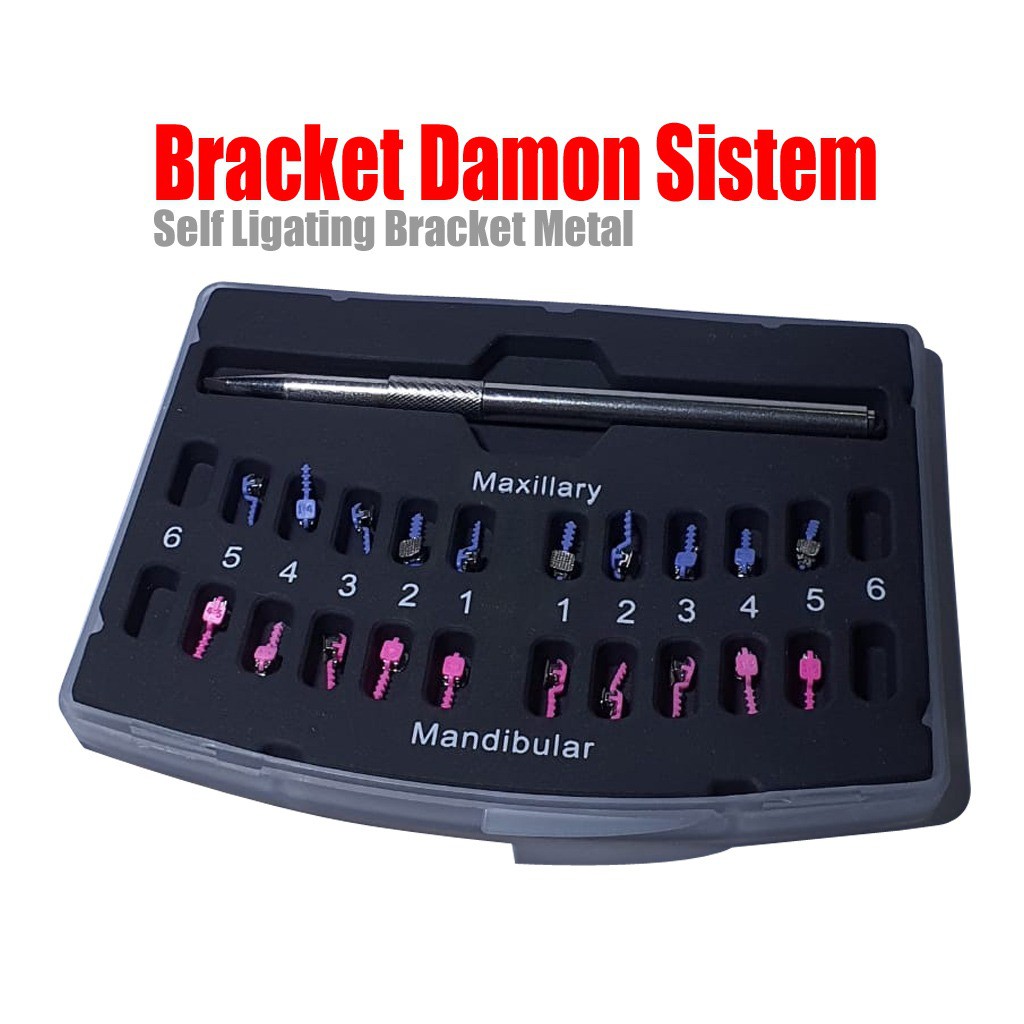 Bracket Damon System self ligating behel damond