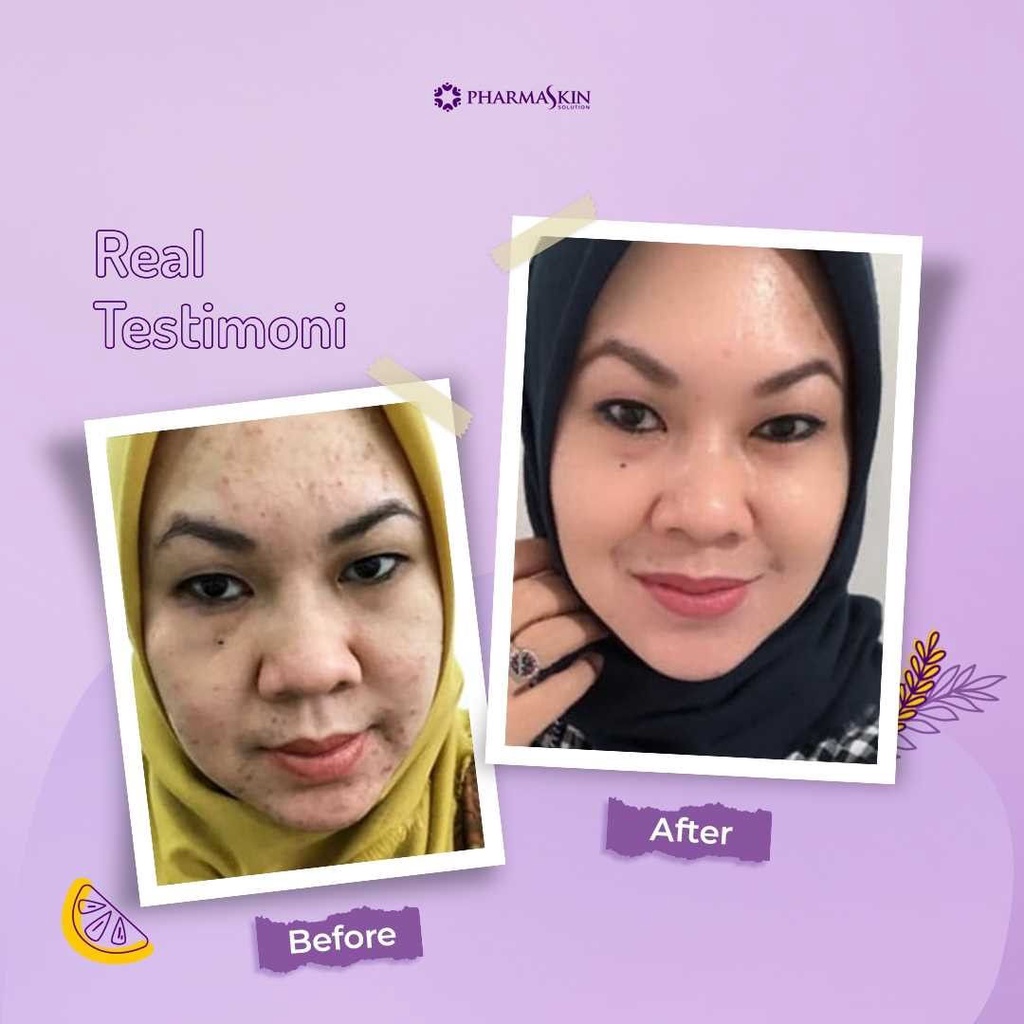 Pharmaskin Paket Full Treatment Acne Glowing Series Bebas Menghilangkan Jerawat Perawatan Wajah Berjerawat Glowing Ampuh Resmi BPOM Halal Original-6