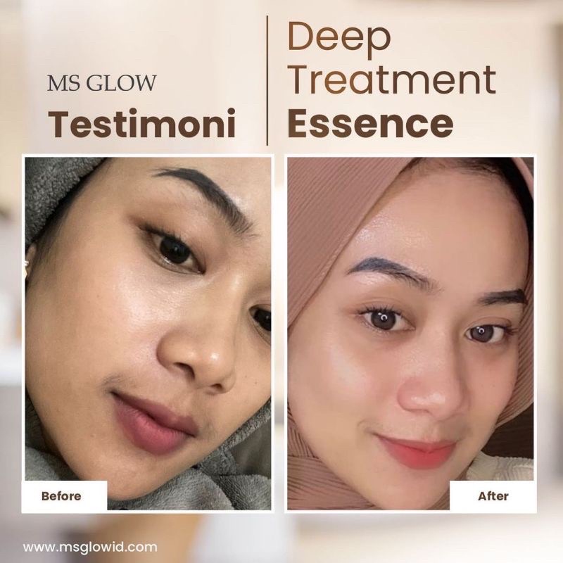 Ms Glow Deep Treatment Essence Salmon DNA