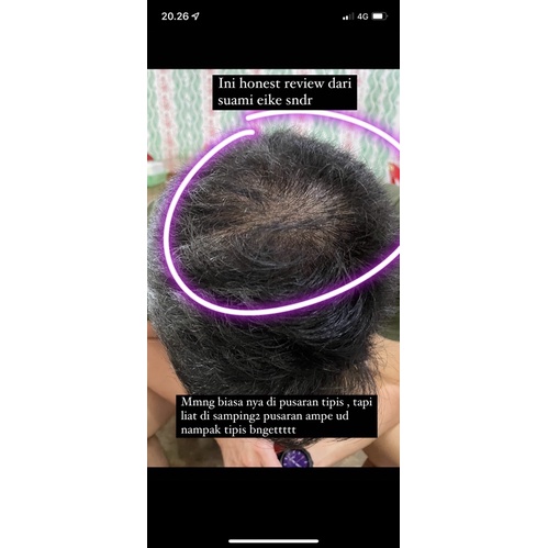 SISSEY SERUM HAIR GROWTH ( beli 4 mixed sissey free gift )