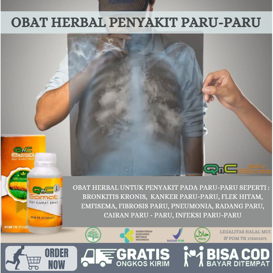 OBAT HERBAL UNTUK BRONKITIS - EMFISEMA - FIBROSIS PARU - RADANG PARU PARU II PROPOLIS SM AMAN BPOM