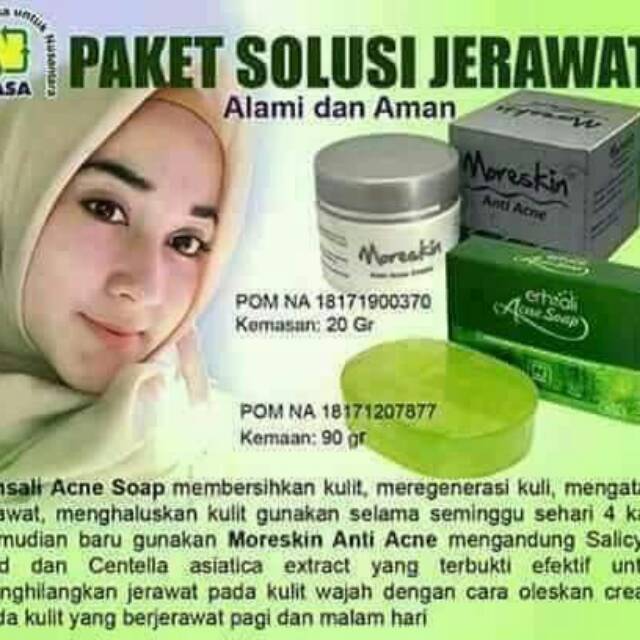 

Xacne