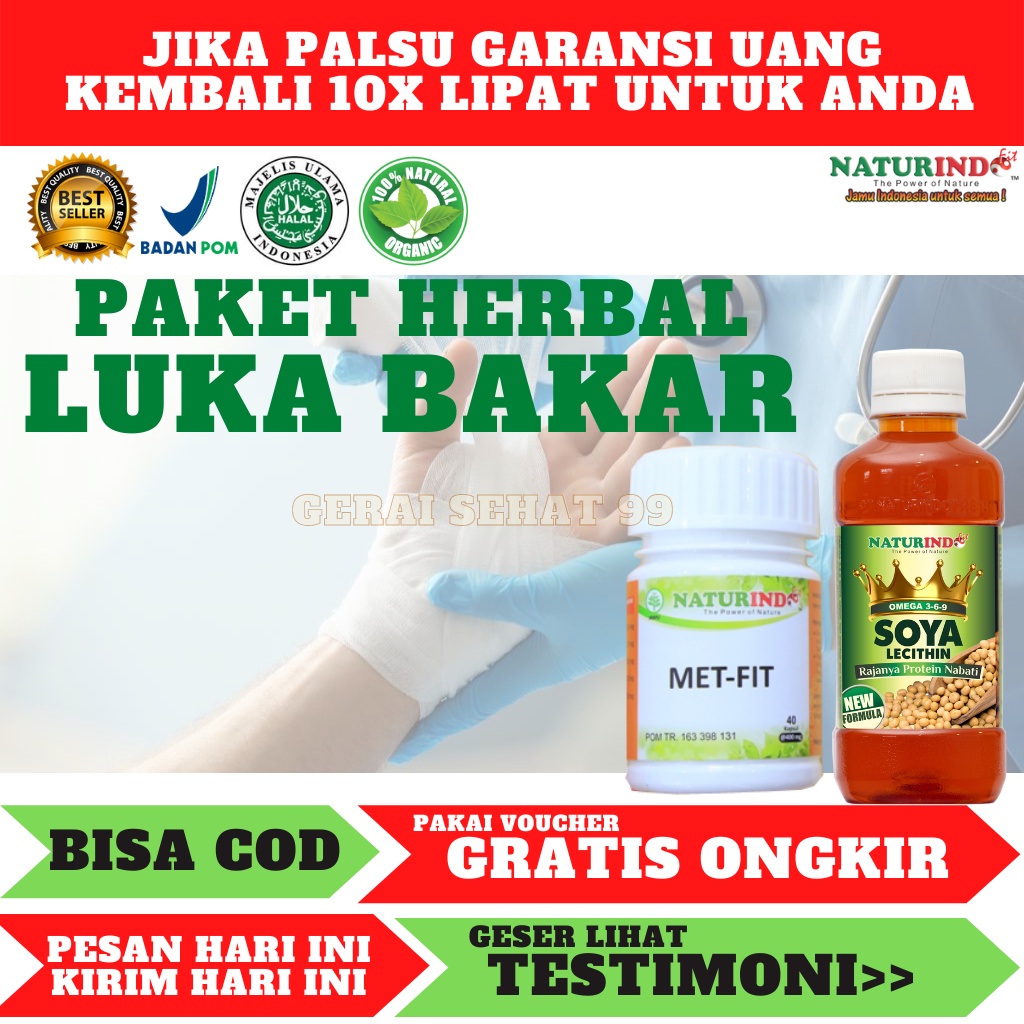 Jual Obat Luka Bakar Melepuh Kenalpot Kena Air Panas Luka Bakar Di