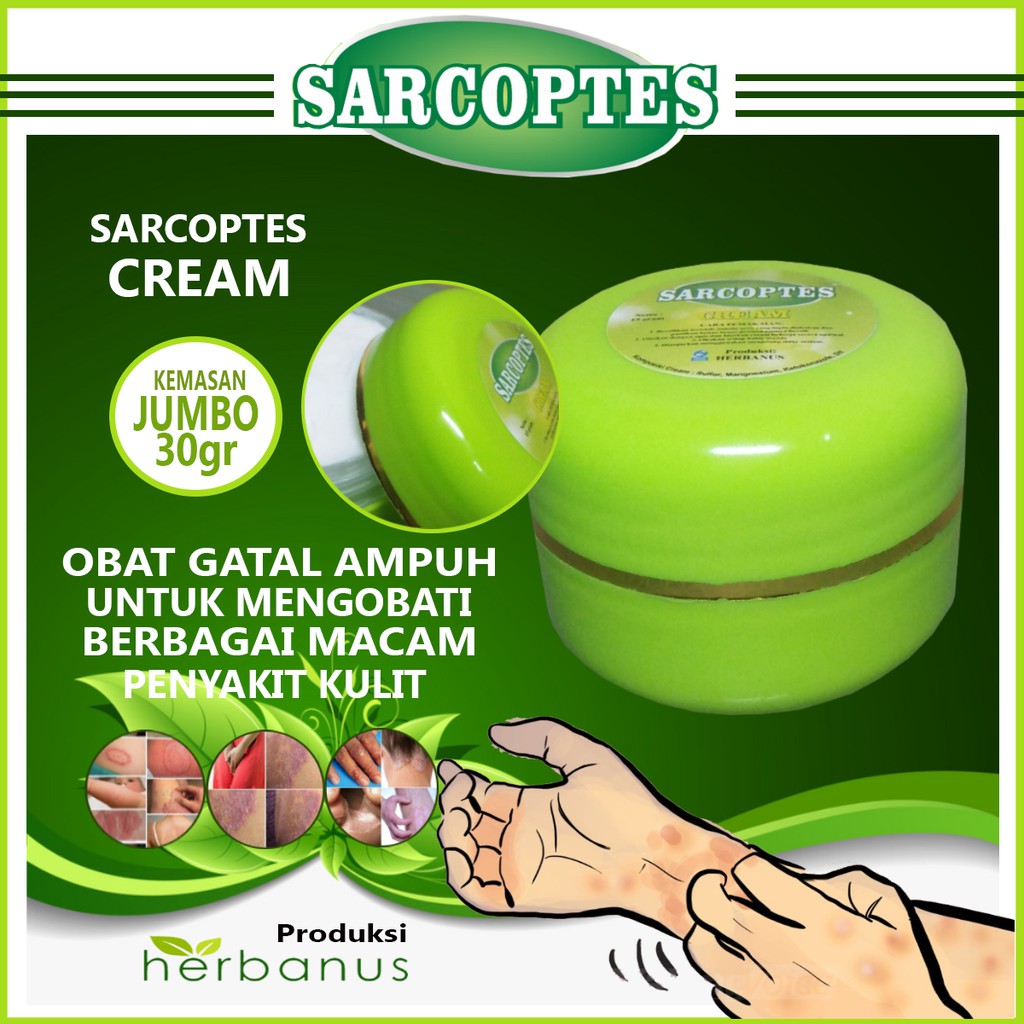 SALEP GATAL MENAHUN SKABIES JAMUR KADAS KUDIS KURAP EKSIM PADA PAHA SELANGKANGAN SARCOPTES