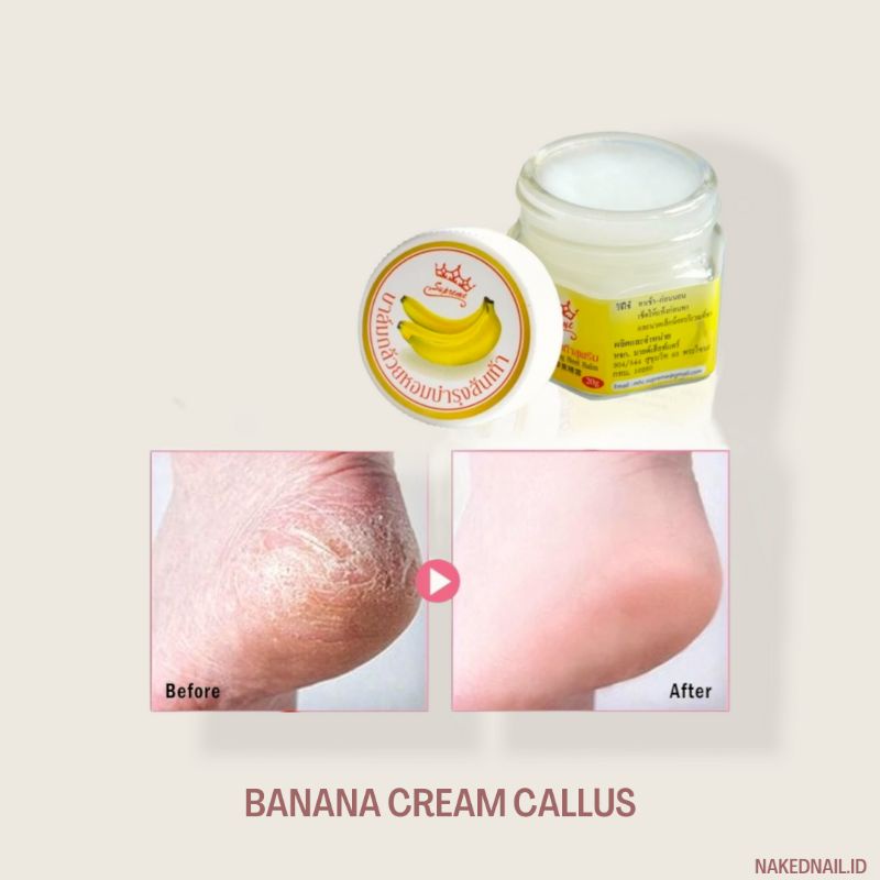 CREAM KAKI / TANGAN PECAH PECAH crack skin / kapalan cream  thailand calluses banana cream original
