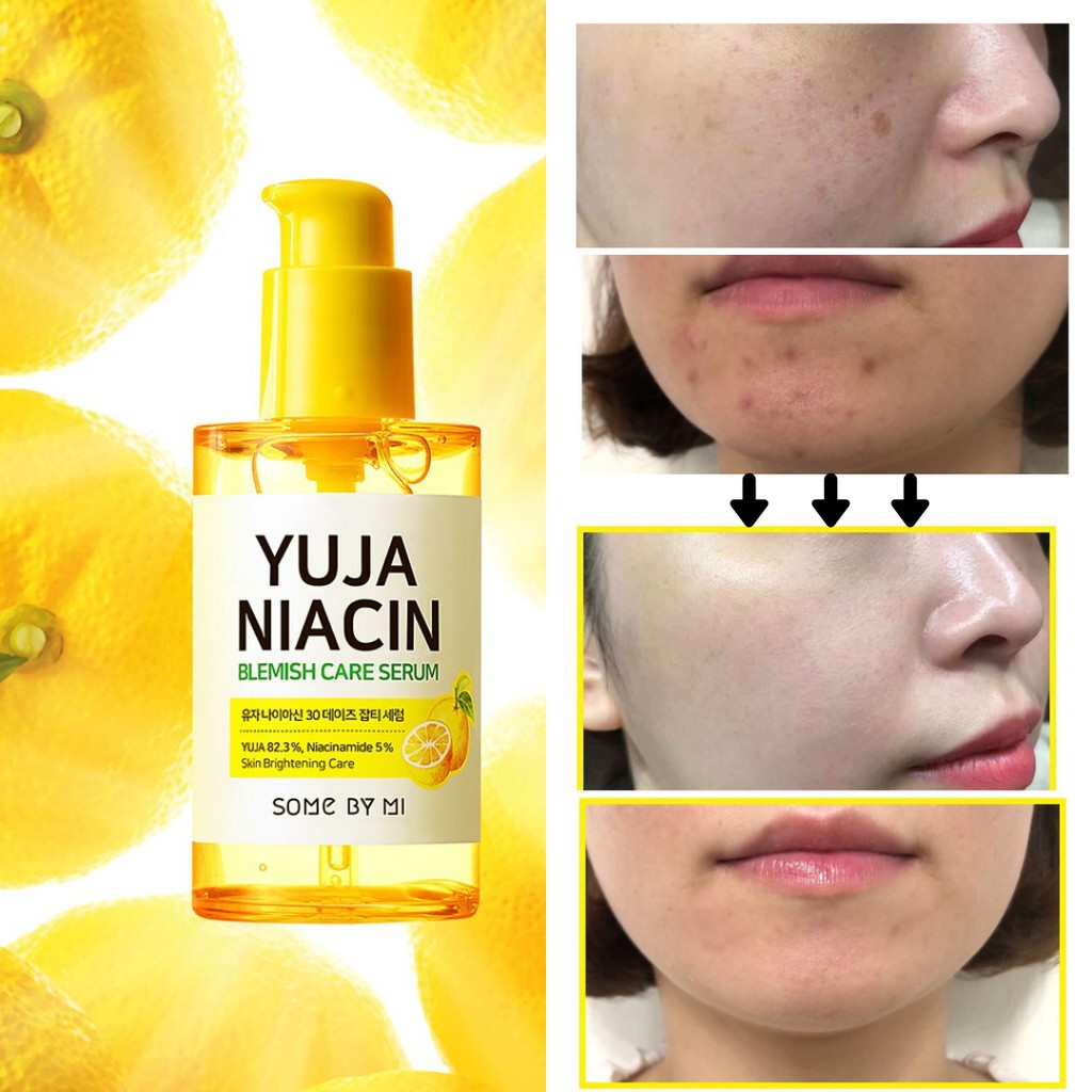 SOMEBYMI some by mi Yuja Niacin 30 Days Blemish Care Serum  50ml