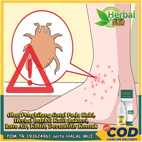 Obat Penghilang Gatal Pada Kaki Gatel Gatal2, Herbal Untuk Infeksi Kulit Bakteri, kutu Air, Kudis