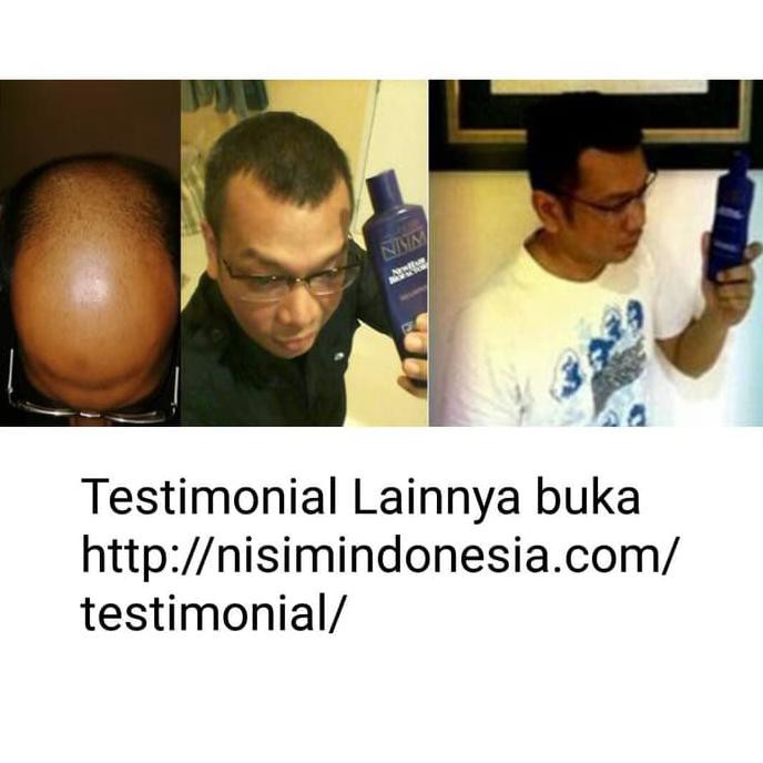 Shampoo Nisim Biofactors + Hair Tonic Nisim Biofactors Normal Minyak