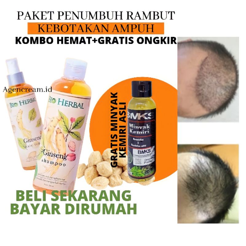 PENUMBUH RAMBUT KEBOTAKAN - PELEBAT RAMBUT - BIO HERBAL GINSENG SHAMPO HAIR TONIC MINYAK KEMIRI