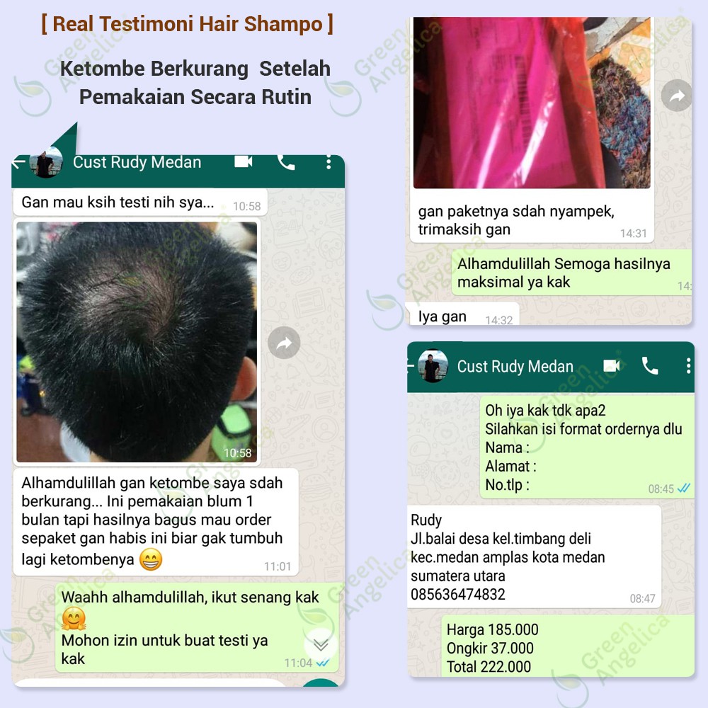 SHAMPO PENUMBUH RAMBUT BOTAK Akibat Rontok Parah, Menghilangkan Ketombe, Shampo Green Angelica BPOM-6
