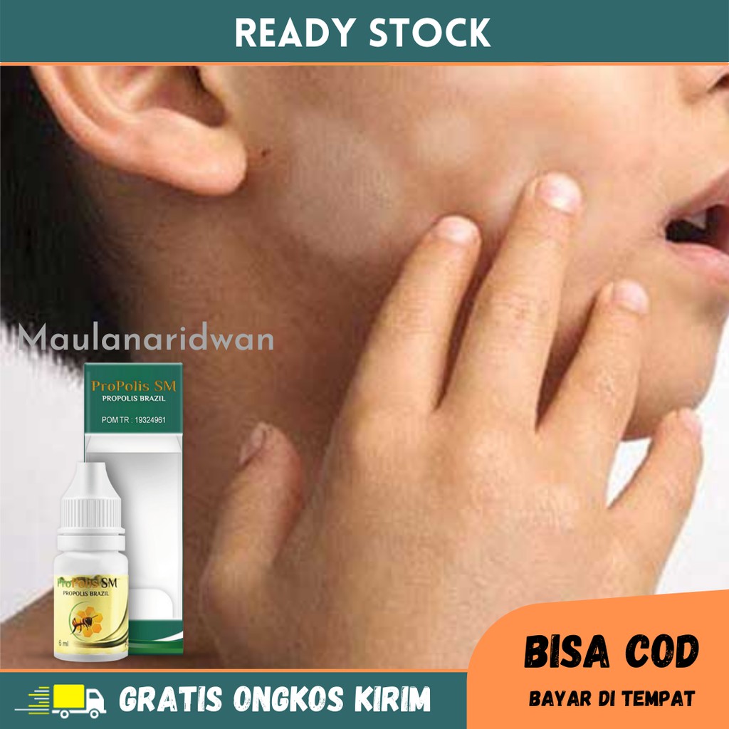 Obat Panu Di Wajah, Kulit Hapuran, Obat Panu Di Leher Dan Punggung, Panu Menahun, Obat Oles Penghila