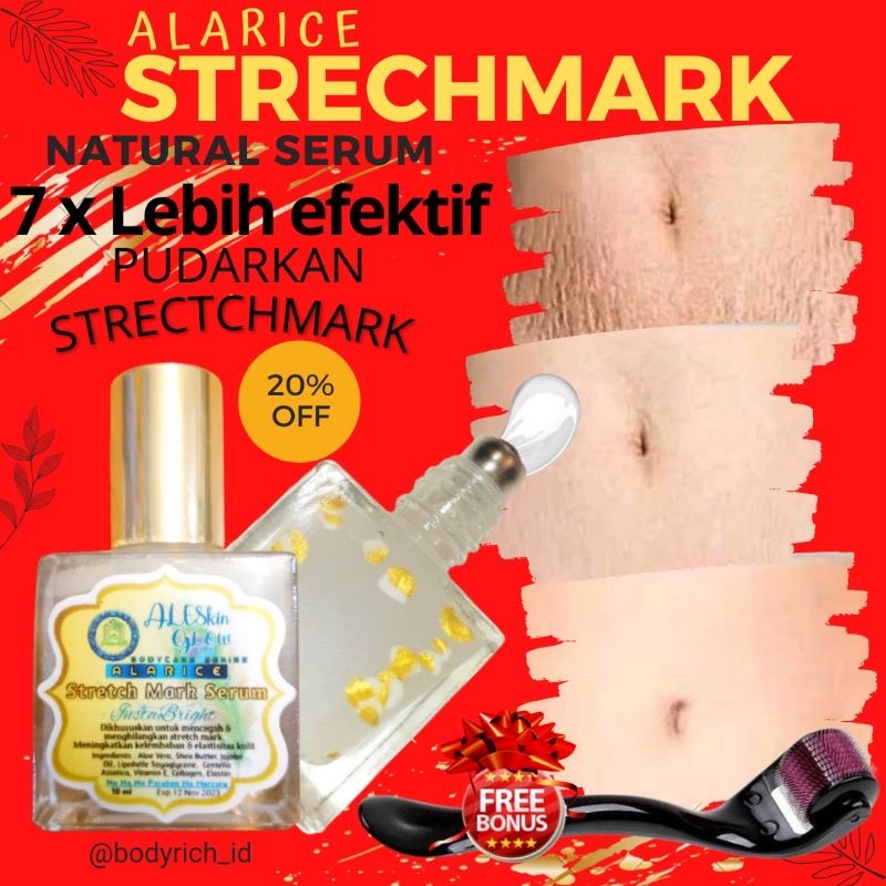 ALARICE STRECHMARK CREAM PENGHILANG STRETCH MARK PALING AMPUH PERMANEN UNTUK IBU HAMIL 1