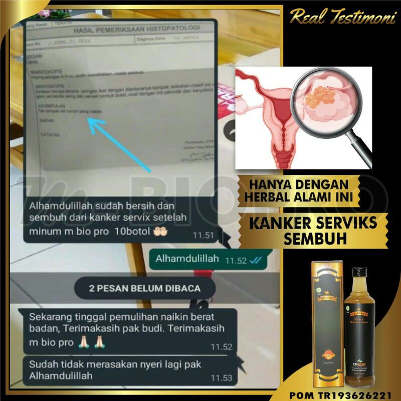 

Obat Herbal Kanker Serviks l Kanker Cervik l Kanker Cervix l Kanker Servik l Kanker Mulut Rahim