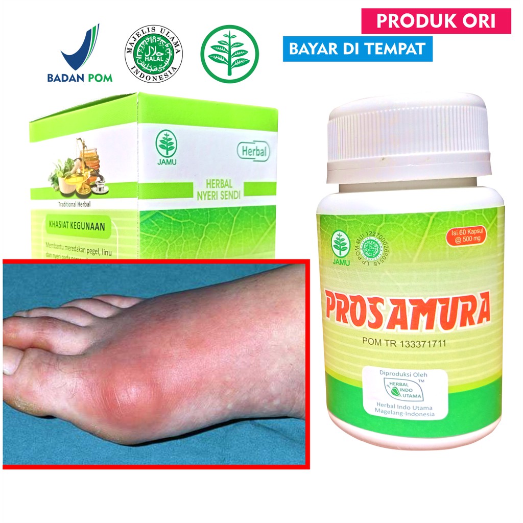 Herbal - Turunkan Asam Urat Nyeri Sendi Pegal linu nyeri sendi BPOM